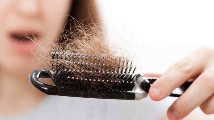 इस Hair loss treatment से 15 दिन में ही मिल जाएंगे "लंबे बाल जिन्हें संभाल नहीं पाएंगे आप" 3 Hair loss treatment
