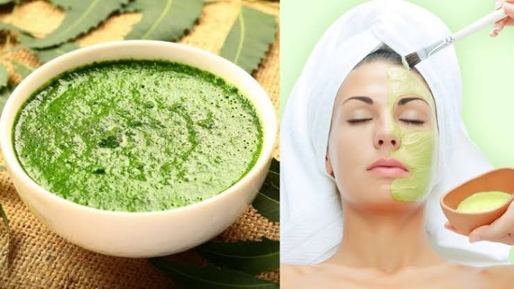 Pimples से छुटकारा पाने के लिए हफ्ते में बस 3 बार लगाइए यह फेसपैक 3 Pimples treatment